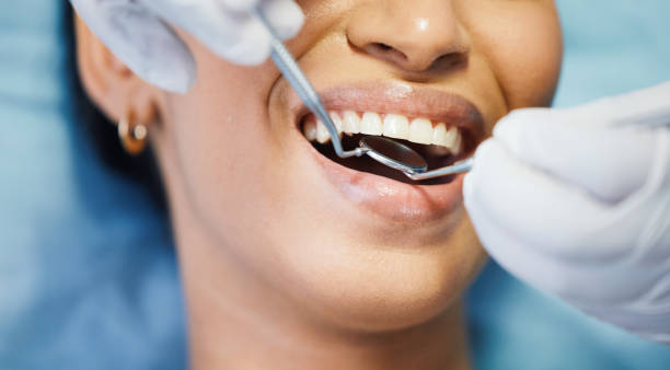Best Knocked-Out Tooth Emergency  in Momence, IL