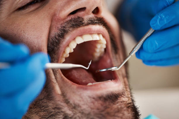 Best Tooth Infection Emergency Dentist  in Momence, IL